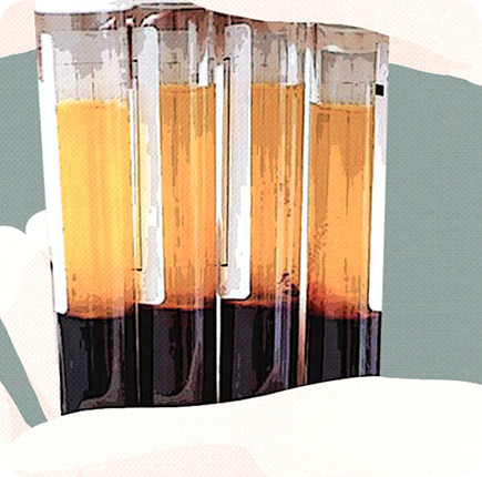  Platelet Rich Plasma Image