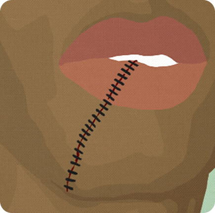 Trauma Craniofacial Surgery Image