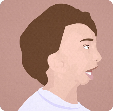 Congenital Craniofacial Surgery Image