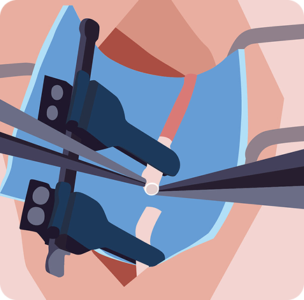 Microsurgery and Free Tissue Transfer Image